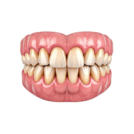 Stained Teeth because of coffee